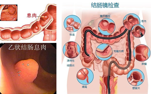 萎縮性胃炎真的“很嚇人”？看完這“七個事實”你就明白了