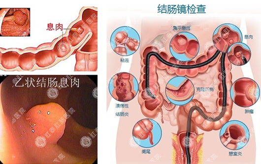 南寧哪家醫(yī)院看胃病治療比較好